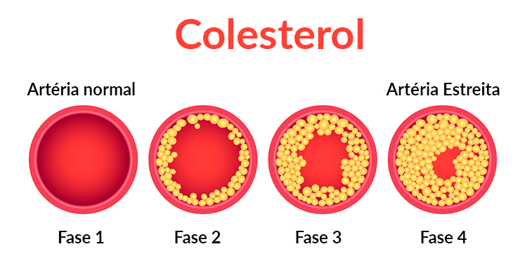 colesterol1.png